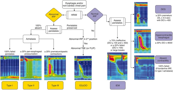 Algorithm for Diagnosis and Management of Esophageal Dysmotility Disorders