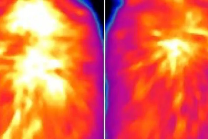 Infrared images of heat production from brown fat in a control mouse (left) and a mouse that lacks a protein called ACOX2 (right). Weisensee Lab