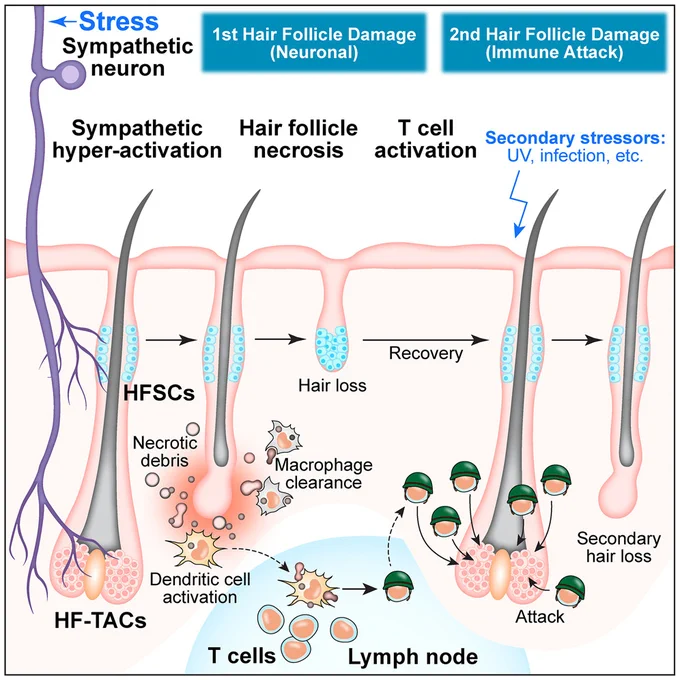 Acute stress causes immediate hair follicle necrosis and hair loss via sympathetic nerves, which in turn activates and expand s autoreactive CD8 ⁺ T cells targeting hair follicles. Thus, a single stress event not only causes immediate tissue damage but also predisposes the tissue to future autoimmune attack.