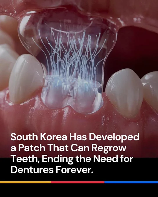 South Korean scientists have unveiled a remarkable dental breakthrough a tiny bioactive patch that can regrow real teeth naturally potentially ending the age of dentures. Instead of replacing missing teeth with artificial prosthetics this patch activates stem cells in the jaw to begin rebuilding enamel dentin and full tooth structure from within the gums.

Placed directly on the area where a tooth is missing it sends biochemical signals that trigger natural regeneration restoring both function and sensation. If human trials continue to succeed this could transform dentistry forever giving millions the ability to grow their own teeth again.