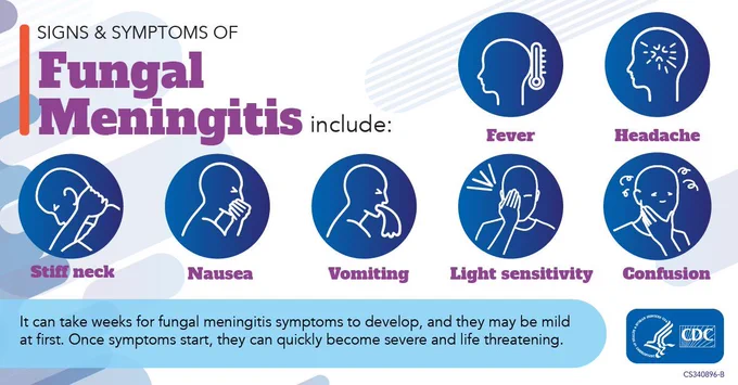 A graphic showing the signs and symptoms of fungal meningitis. 