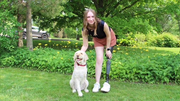 Person with a prosthetic leg kneeling in a park next to a fluffy dog, surrounded by green grass and small yellow flowers.