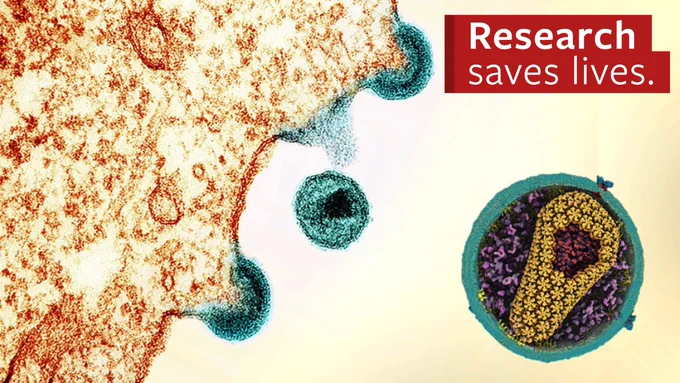 A transmission electron micrograph of HIV-1 virus particles (teal) exiting an infected immune cell after replicating inside the cell. The inset (circle) shows the capsid (yellow) that surrounds the RNA and enzymes necessary for replication next to the text "Research saves lives." The image emphasizes the texture and details of the virus structure in warm tones.