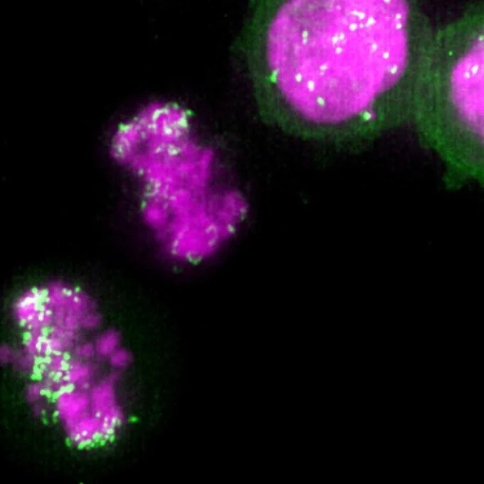 Stanford Medicine: Cancer-promoting DNA circles hitchhike on chromosomes to spread to daughter cells