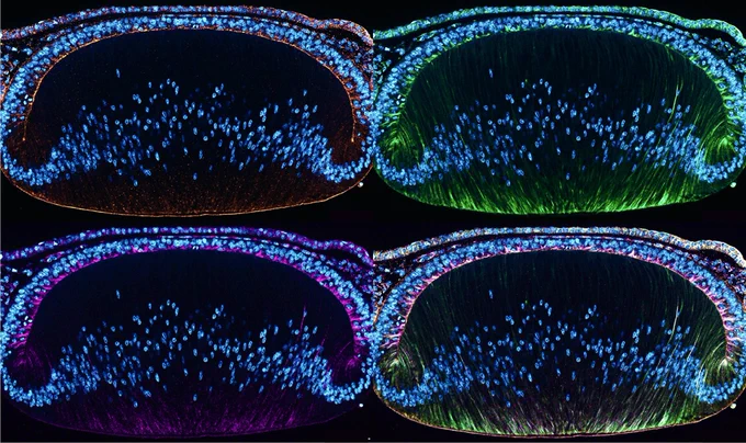 Transverse sections of the developing eye with IHC for tubulin proteins and blue is DAPI.