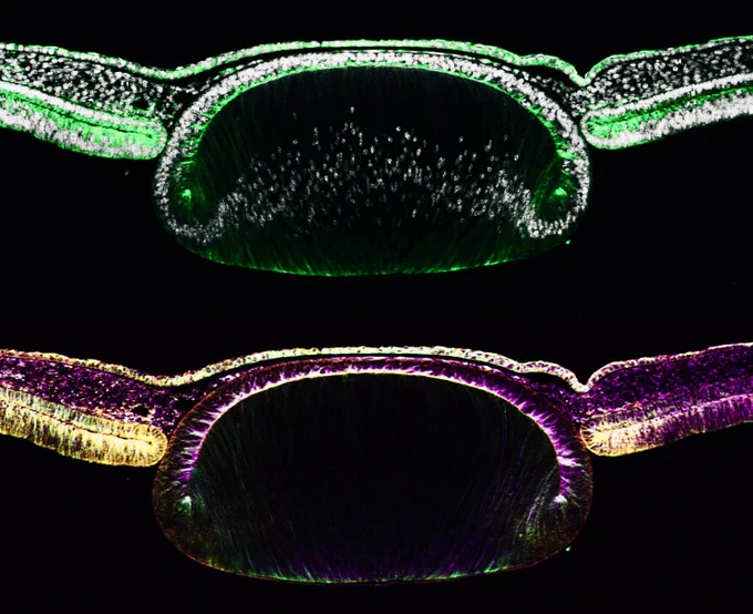 Transverse sections of the developing eye with IHC for tubulin proteins and white is DAPI.