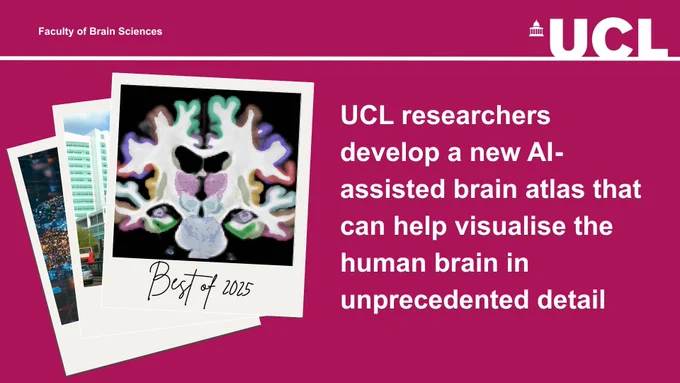UCL researchers develop a new AI-assisted brain atlas that can help visualise the human brain in unprecedented detail 