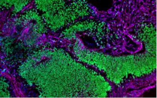 NIAID sourced image depicting Brain organoid depicting neural stem cells in green and neurons in magenta. Both cell types are abundant, showing normal development. 