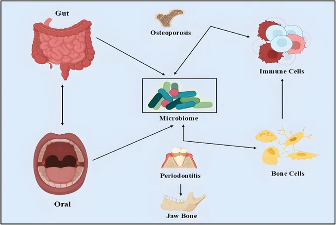 Fig. 2. Interconnection between gut and oral microbiota in regulating bone and immune function. Dysbiosis in either site contributes to systemic and local inflammatory responses, influencing bone remodelling and promoting diseases such as periodontitis and osteoporosis through immune signalling pathways.