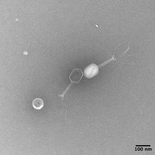 Electron microscopic image of a Klebsiella targeting bacteriophage
