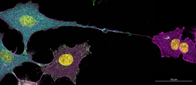 Fluorescent microscopy image showing three large, irregularly shaped cells with colorful staining. Each cell has a bright yellow nucleus, while the surrounding cytoskeleton is highlighted in different colors: teal, magenta, and purple. The cells are connected by thin, elongated extensions, and the background is black. A scale bar at the bottom right indicates 50 µm.