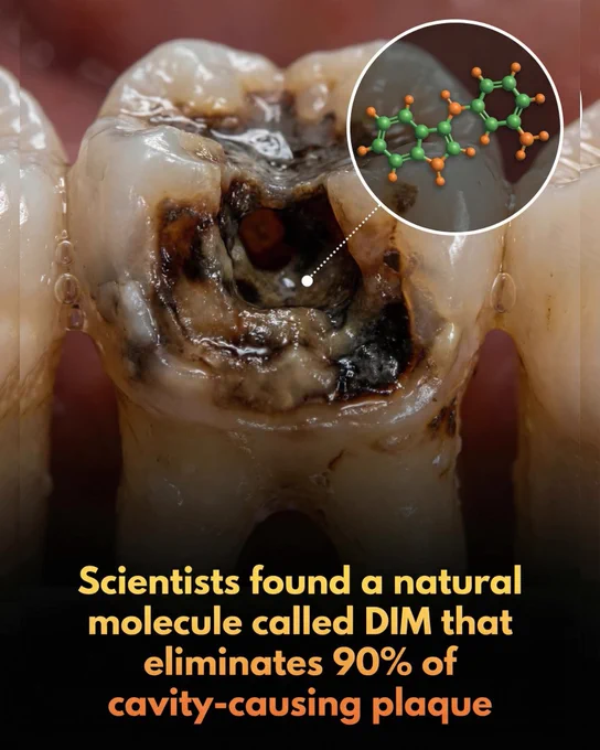 A molecule in cruciferous vegetables has been found to eliminate cavity-causing bacteria. 

Hiding within your daily serving of broccoli and cabbage is a powerful molecule that could transform the future of dental care. 

Known as 3,3′-diindolylmethane (DIM), this natural compound has demonstrated a remarkable ability to dismantle the protective defenses of Streptococcus mutans, the primary bacteria responsible for tooth decay. 

In recent laboratory studies, DIM successfully eliminated up to 90% of bacterial biofilms by preventing the formation of the sticky layers that allow plaque to thrive on teeth. By stripping away this biological shield, the compound leaves harmful microbes significantly more vulnerable and easier to remove.

The potential applications for DIM extend far beyond the laboratory, as researchers suggest it could become a standard additive in toothpaste, mouthwash, and other oral-care products. Unlike harsh chemicals, this plant-derived molecule offers a low-toxicity