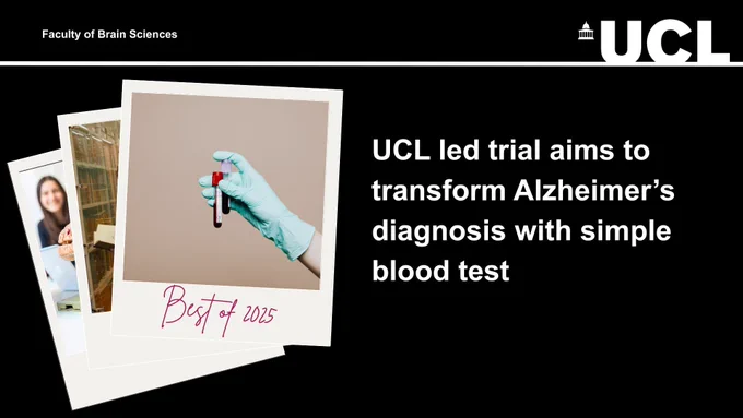 UCL led trial aims to transform Alzheimer’s diagnosis with simple blood test