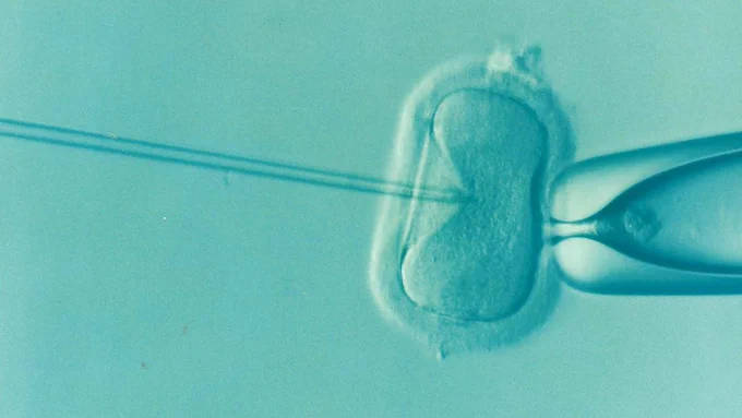DrKontogianniIVF “Ivf, Fertility, Infertility image” Published July 14, 2016 (Pixabay) Free for use