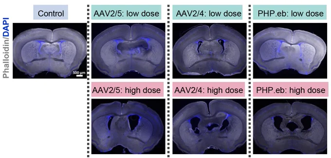 Representative coronal sections at the level of the posterior anterior commissure (pAC; dashed outline) showing lateral ventricle morphology in P7.5 brains following P0.5 ICV injections. 