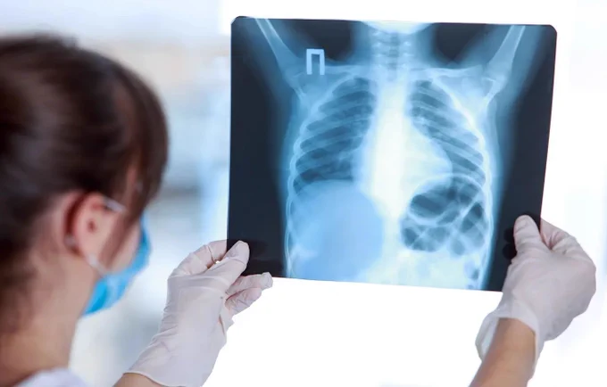 Image Source: https://www.medicaldevice-network.com/news/bering-chest-x-ray-triage-solution/