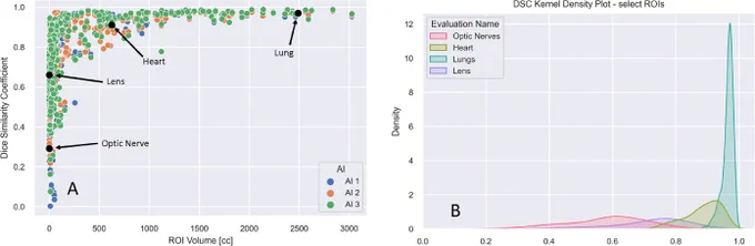 Figure 3. Scatter plot of ROI volume versus DSCs for 527 patient-specific ROIs for AI1, AI2, and AI3. Artificial intelligence autocontouring solutions with (A) several select ROIs and (B) distribution of DSC across several select ROIs, which are represented by kernel density plots across all 3 artificial intelligence solution-generated contours. Abbreviations: DSC = dice similarity coefficient; ROI = region of interest.