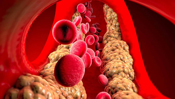 Computer-generated image of triglycerides 