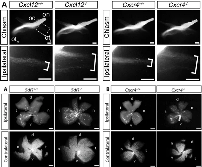 a scientific image showing an axon guidance defect of the visual pathway. Losing either Cxcl12 or its receptor, Cxcr4, results in the misrouting of crossing axons at the midline, leading to a birth defect in the visual pathway.

