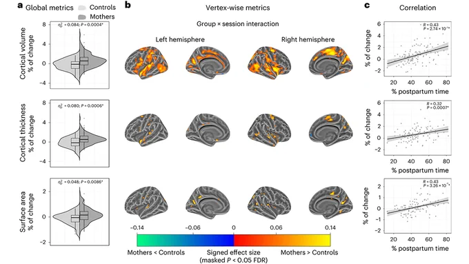 This is figure 3, which shows longitudinal changes in cortical volume, thickness and surface area from late pregnancy to early postpartum in mothers compared to nulliparous women.