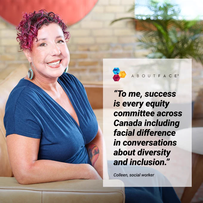 a woman wearing a blue dress looks at the camera. A text box with a quote reads "To me, success is every equity committee across Canada including facial difference in conversations about diversity and inclusion."