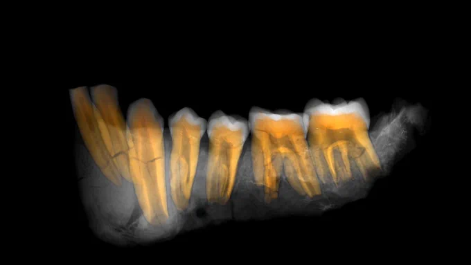micro-CT volume rendering of OH 7 mandible and teeth
