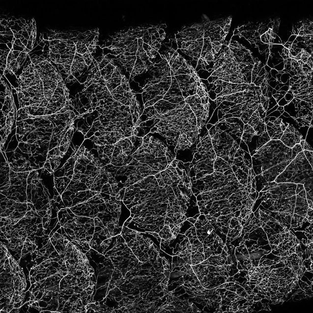 Somatosensory axons in juvenile zebrafish skin