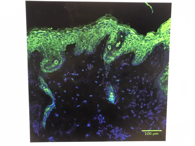 Human skin stained with green fluorescent antibodies against keratinocytes