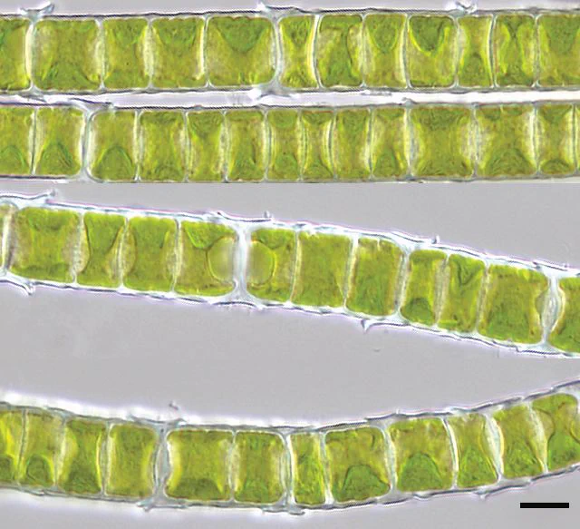 Microscope image of the filamentous alga Klebsormidium crenulatum, a land-dwelling alga that is very dessication resistant due to its thick cell wall. (scale is 10 µm, corresponding to 0.01 mm)