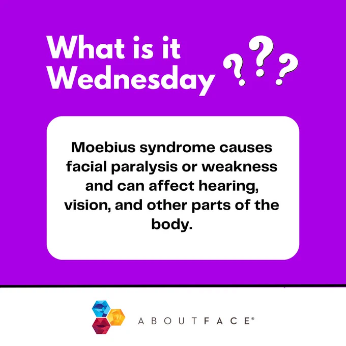 purple background with white text that reads "what is it wednesday" with white question marks. Black text on white background reads "Moebius syndrome causes facial paralysis or weakness and can affect hearing, vision, and other parts of the body." 