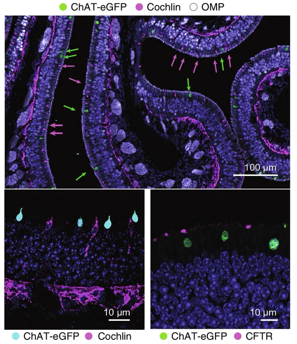 Cross section of olfactory epithelium of ChAT-eGFP mice stained for ChAT-eGFP (tuft cells), cochlin and  CFTR (ionocytes), and OMP (olfactory sensory neurons (OSNs), top image). Hoechst (blue) was used to mark nuclei in all images. Green arrows point at tuft cells and magenta arrows point at ionocytes in the top image.