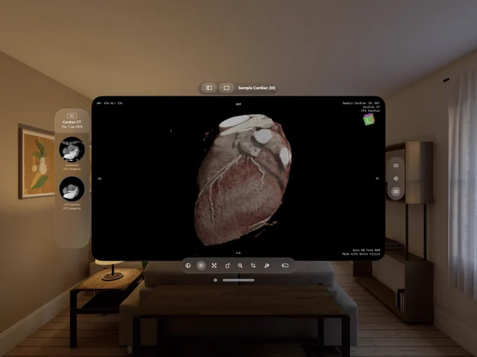 An application window in Apple Vision Pro depicting the Falcon Vue application showcasing a 3D photorealistic volume rendering of a heart.