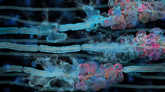 Illustration depicting tumors forming in Schwann cells, which normally make the myelin that protects nerves. Art by Ken Probst.