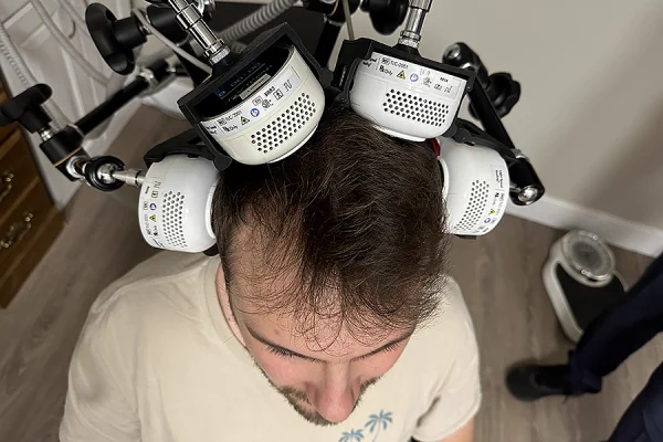 White and black device hovers overtop of patients head.