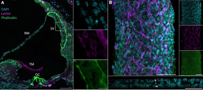 Postnatal day 30 cross section of a cochlear turn (A) and postnatal day 0 wholemount stria vascularis (B) stained with Phalloidin for actin (green), Lectin for blood vessels (magenta) and DAPI for nuclei (cyan). Orthogonal view of the wholemount SV in bottom panel of (B) marks nuclei of the three cell layers of the stria.