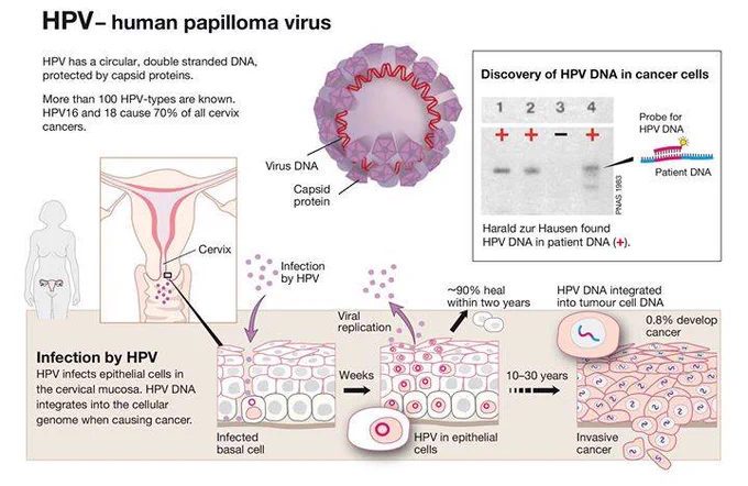 A graphic explaining HPV.