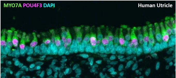 Image showing the sensory epithelium of a human utricle with hair cell bodies labeled with #myosin (green), #HairCell nuclei labeled with the transcription factor POU4F3 (magenta) and DAPI for all nuclei (cyan).