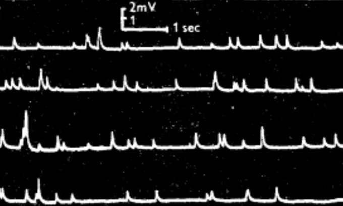 Fatt & Katz 1952, Fig. 1 - example of miniature end plate potentials in a muscle