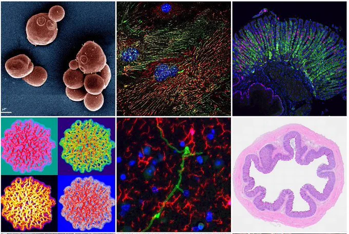 6 microscopy images including spherical yeast cells, astrocyte cells in the mouse brain, microvascular endothelial cells,  the fungi Candida parapsilosis,   Candida albicans an chicken caeca. 