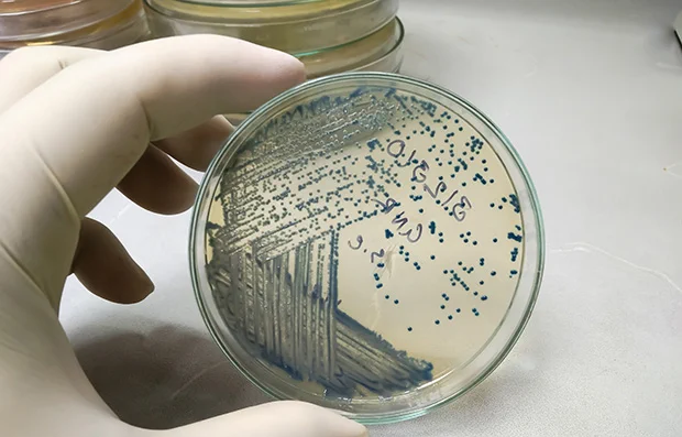 a gloved hand holds a clear dish which contains many blue dots and lines