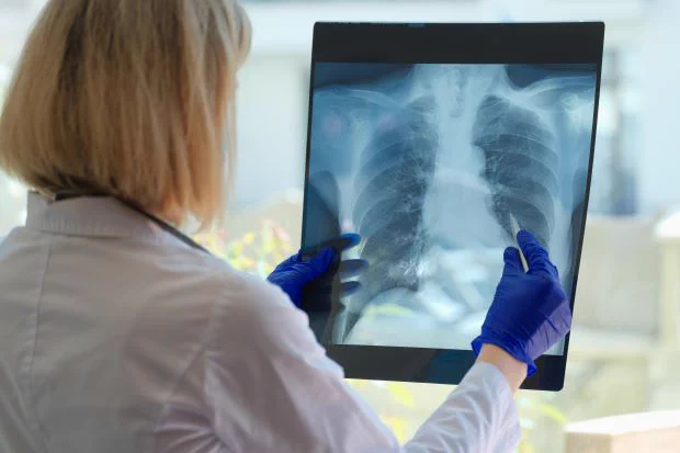 a person wearing a white coat and blue gloves looks at an xray image of a chest