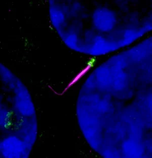 Mouse islet cilium nestled among three nuclei; axoneme (acetylated tubulin) in magenta, basal body (FOP) in green.