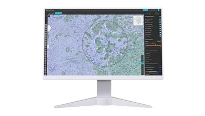 Image Source: https://www.prnewswire.com/news-releases/new-study-demonstrates-predictive-value-of-lunit-scope-io-to-predict-outcomes-of-immune-checkpoint-inhibitor-therapy-across-diverse-tumors---published-in-the-jitc-302064098.html