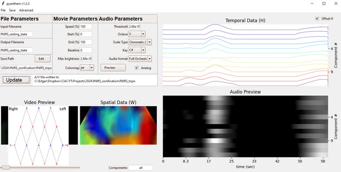 Audiovisualization of functional near-infrared spectroscopy (fNIRS) resting-state HbO data from the prefrontal cortex in an adult male. The fNIRS probe configuration includes 22 long-distance channels (SD=30 mm) and 2 short-separation channels (the latter are not displayed here and are used solely to regress superficial physiology). The data were filtered to isolate the functional connectivity band, ranging between 0.009 and 0.08 Hz, and interpolated onto a 256x128 pixel grid, covering an area of 105x52 mm. Only positive relative changes of HbO are shown. This presentation's original duration of 361 seconds has been compressed to 61 seconds.
Tools used: pyanthem, fluidsynth, ffmpeg, miniconda, Python 3.7, MATLAB, HOMER3, and custom scripts.
Reference: Thibodeaux, D. N. et al. (2024). Audiovisualization of real-time neuroimaging data. PLOS ONE, 19(2), e0297435. https://doi.org/10.1371/journal.pone.0297435