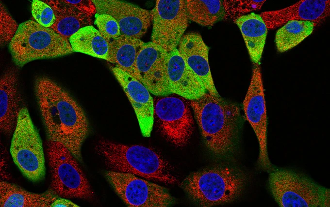 Microscopy image of ASFV infected cells