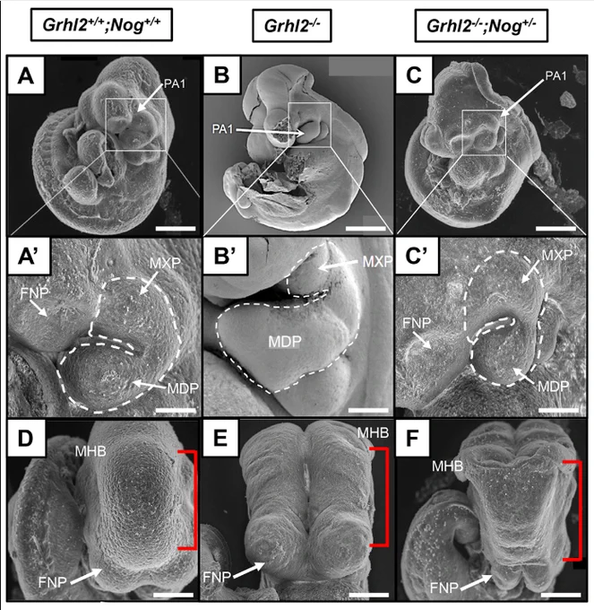 Figure 2A-F: Scanning electron microscopy shows rescue of Grhl2−/− phenotypes following reduction of elevated noggin expression.