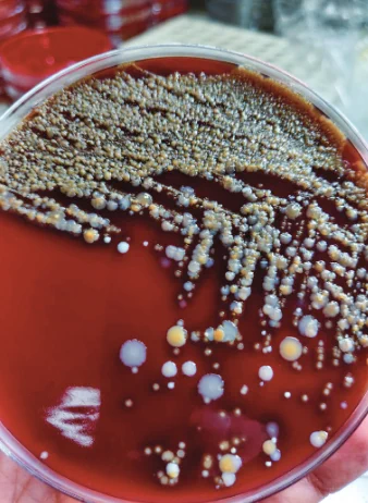 Mixed bacteria culture from a diabetic foot ulcer obtained before
spaceflight.