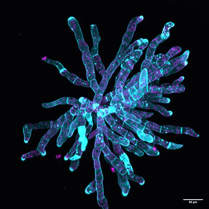 Macrocystis pyrifera (giant kelp) gametophyte, imaged with confocal microscopy. Many filaments of cells originate from a central point.
