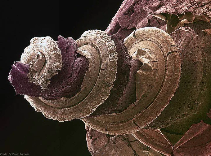 A SEM image of the cochlea