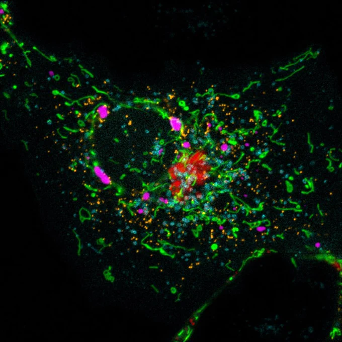 A cell expressing various fluorescent organelle labels